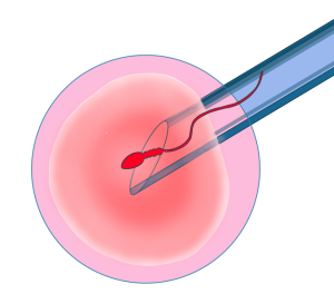 胚胎本身质量不好-泰国试管婴儿帕雅泰3